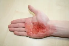 EZ Wounds – Wundensimulation Basic