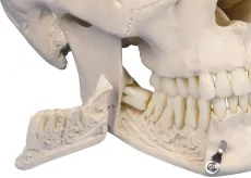 Dental-Schädel, 4-teilig