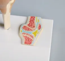 Mini-Kniegelenkmodell mit Querschnitt