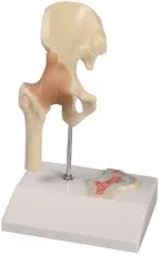 Mini-Hüftgelenkmodell mit Querschnitt