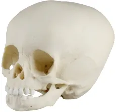 Kinderschädel, 15 Monate