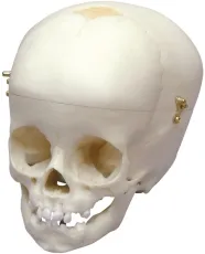 Kinderschädel, 12 Monate
