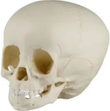 Kinderschädel, 1 ½-jährig