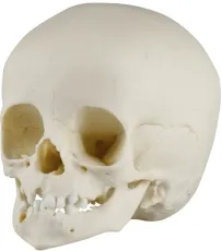 Kinderschädel, 14 Monate