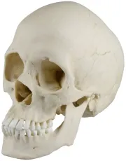 Skaphozephaler Schädel