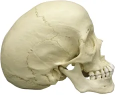 Skaphozephaler Schädel
