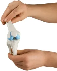 Knie-Implantat-Modell