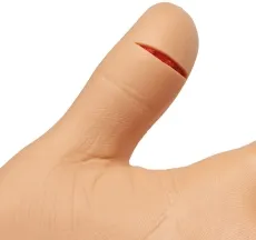 Naht-Arm