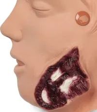Wundsimulations-Set für Puppen