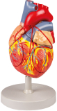 Herz mit Bypass, 2-fache Lebensgrösse, 2 Teile - Modell