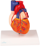 Herz mit Bypass - Modell