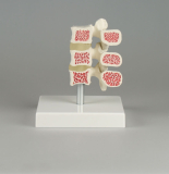 Osteoporose-Wirbel-Modell