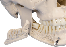 Schädel mit Zähnen