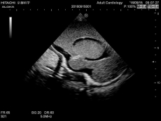 Neonatales Ultraschall-Übungsphantom Kopf