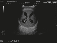 Neonatales Ultraschall-Übungsphantom Kopf mit Hydrocephalus