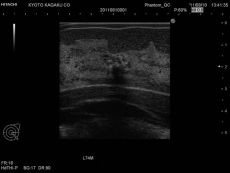 Ultraschalluntersuchungsphantom-Brust