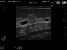 Ultraschalluntersuchungsphantom-Brust